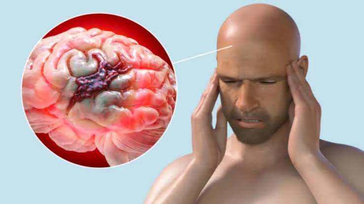 brain-tumor-surgery